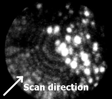 Tip after scan